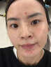 南京同仁堂祛痘膏去痘痘和痘印痘坑修復男女士改善粉刺閉口30g 曬單實拍圖