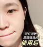 白云山377煙酰胺面霜美白祛斑霜淡化黑色素去老黃斑雀斑抗氧化保濕50g 曬單實(shí)拍圖