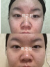 儒意（RUYI）377美白面膜補(bǔ)水男女士保濕淡斑提亮膚色抗皺緊致抗衰老去黃金榜 曬單實(shí)拍圖