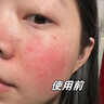 奈皙日本曬后修復面膜急救敏感泛紅女男士夏季神經(jīng)酰胺改善醫美用煥白 曬單實(shí)拍圖