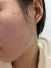Ulike超光炮Pro美容儀器【七夕情人節(jié)禮物】 家用光子嫩膚 牛奶光淡紋美白提亮緊致 生日送女朋友老婆 曬單實(shí)拍圖
