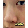 儒意去角質(zhì)面部啫喱控油保濕洗面奶男女士臉部清潔毛孔黑頭閉口敏感肌 【一次見效】去角質(zhì)啫喱 300g 曬單實(shí)拍圖