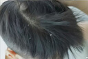 ZCL控油去屑洗發(fā)水露男女士二硫化硒止癢持久蓬松留香胖東洗頭膏液來 曬單實拍圖