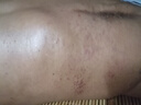 云南真菌王特效皮膚瘙癢外用全身皮膚手腳干癢真菌止癢膏殺菌 買(mǎi)3送2【五盒裝】爆銷(xiāo)套裝 曬單實(shí)拍圖