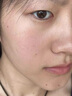 康佳（KONKA）黑頭吸出器吸黑頭儀器清理神器面部小氣泡清潔美容儀男女士毛孔粉刺清潔器生日禮物送男女友 全配款-小氣泡清潔儀+精華水+氣泡水+6種吸頭 曬單實(shí)拍圖