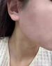 Newliann醫(yī)用祛痘貼去痘痘和痘印消炎吸膿隱形修復(fù)膏淡化痘坑痤瘡專用制藥 曬單實拍圖