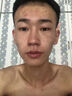 YYTISS祛痘淡化痘印去痘痘和痘印黑色素沉淀痘坑修疤復(fù)青春痘祛痘膏學(xué)生 曬單實(shí)拍圖