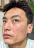 ALORMIRV法國火山泥男士洗面奶控油祛痘除螨蟲(chóng)去黑頭深清潔面乳補水保濕 2盒火山泥潔面乳【控油祛痘】99%顧客選擇 曬單實(shí)拍圖