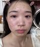 中藥面膜祛痘消炎痤瘡專用祛痘淡化痘印祛痘印控油祛痘毛孔收縮 一盒裝(贈九件套調(diào)模工具)中藥祛痘面膜 曬單實拍圖