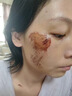 藤石制藥去疤痕黑色素沉淀沉著摔傷擦傷燙傷祛痘印淡化修復(fù)除疤去除黑印WQ 單盒裝 面部身體消除黑紅印藥房同售膏 曬單實(shí)拍圖