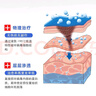 液氮冷凍疣醫用京東大藥房東京營(yíng)自冷凍劑hpv醫用噴管罐裝液激光+ 液氮500ml*1瓶 曬單實(shí)拍圖