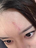 邦孚手祛疤膏去祛疤痕修復(fù)凝膠醫(yī)用醫(yī)院專(zhuān)用去疤膏硅酮去疤痕藥膏除疤膏 曬單實(shí)拍圖
