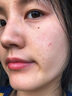 維特絲（vetes）去角質(zhì)面部啫喱控油保濕洗面奶男女士清潔毛孔黑頭閉口溫沒激素和 【6大專利】果酸去角質(zhì)啫喱200g 曬單實(shí)拍圖