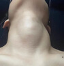 秋雅奈緒甲狀腺結(jié)節(jié)散結(jié)貼專(zhuān)用膏藥貼100%治甲亢脖子粗大頸部不適呼吸困難 買(mǎi)2送1【100%必冶好】 進(jìn)口穴位散結(jié)貼專(zhuān)消甲狀腺 曬單實(shí)拍圖