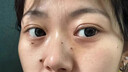 dyey祛痣點痣膏無痕臉部黑痣扁I平疣痦子瘊子祛斑點斑非薬水面部專用 曬單實拍圖