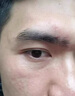 Newliann醫(yī)用重組三型人源化膠原蛋白外用人表皮生長因子凝膠皮膚疤痕修復 曬單實拍圖