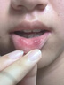牙得康一點(diǎn)靈非牙得安一點(diǎn)靈抑菌液宏米抑菌清潔液涂抹棒牙痛不適 一盒【贈20支涂藥棒】 曬單實(shí)拍圖