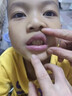 巴貝奇  BABBAGE防咬下嘴唇矯正神器牙套糾正小孩地包天牙齒矯正牽引器兒童6-12歲 兒童初期【偏軟】不自覺咬下唇 曬單實拍圖