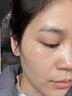 白云山377煙酰胺面霜美白祛斑霜淡化黑色素去老黃斑雀斑抗氧化保濕50g 曬單實拍圖