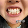 Deliiston美白牙膏口臭去黃去牙漬去煙漬牙垢牙結(jié)石清新金榜第一名*2瓶  曬單實(shí)拍圖