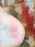 傾姿堂腳氣噴劑止癢脫皮爛腳丫真菌感染去水泡型腳汗腳臭專(zhuān)用噴霧35ML 曬單實(shí)拍圖