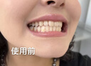 Dr.HaGisenl哈吉森博士醫牙結石去除神器溶解牙石速效清理漱口水殺菌除口臭煙漬牙黃牙垢 30ml 曬單實(shí)拍圖