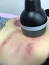 黑美人隔空爆減體雕儀疏通經(jīng)絡(luò)做身體刮痧排濕塑形儀器美容院專用 單頭+負(fù)壓 曬單實(shí)拍圖