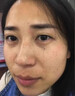 焦博士日本熊果苷乳膏煙酰胺凝膠377美白祛斑霜祛斑美白淡化黑色素面霜 曬單實(shí)拍圖