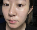 OHBT祛痘膏60g青春痘閉孔粉刺收縮毛孔專用學(xué)生男女凝膠男士化妝品 曬單實拍圖
