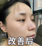 片仔癀美白祛斑膏祛斑霜淡化黑色素去雀斑老年黃褐斑祛斑面霜國貨護膚女 美白祛斑膏1瓶【送防曬霜】 50g 曬單實(shí)拍圖