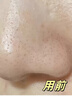 儒意紫蘇清潔泥膜深層清潔去黑頭粉刺閉口收縮毛孔水楊酸面部涂抹面膜 【黑頭救急】紫蘇清潔泥膜 130g 曬單實拍圖
