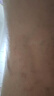 本田制藥靜脈曲張專用膏藥貼蚯蚓腿青筋凸起血管堵塞疏通可搭冷敷凝膠1盒 曬單實拍圖