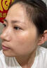 泊泉雅祛斑霜老年斑專用特效非藥一夜消美白祛斑黃褐雀斑曬斑男女士專用 醫(yī)用膏 20g 1盒【男女醫(yī)用】 祛斑去黑色素377臉部手背祛斑專用霜去老人斑正品 曬單實拍圖