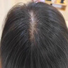 kuvive防脫育發(fā)洗發(fā)水500ml生姜洗發(fā)露男女士固發(fā)養發(fā)米諾地爾金榜第1名 曬單實(shí)拍圖