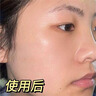 Newliann醫用祛痘貼去痘痘和痘印消炎吸膿隱形修復膏淡化痘坑痤瘡專(zhuān)用制藥 曬單實(shí)拍圖