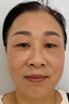 碧柏雅川字紋去除神器貼去皺紋去法令紋去抬頭紋男女去除填充針劑睡覺(jué)貼 單盒裝 皺眉紋額頭川字紋去皺貼 曬單實(shí)拍圖