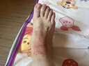 APGMA苗藥濕毒清軟膏頑固濕疹藥止癢去病根有濕毒皮膚瘙癢皮炎濕疹專(zhuān)用 特效3盒裝【買(mǎi)二送一】98%的選擇 曬單實(shí)拍圖