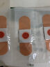 云南本草雞眼貼雞眼膏去腳根肉刺藥膏無(wú)痛脫落扁平疣手足老繭腳底趾疣刺猴 曬單實(shí)拍圖