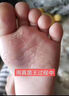香港大藥房有限公司真菌王手足癬感染皮炎濕疹腳氣止瘙癢脫皮爛腳丫皮膚用抗藥抑膏 曬單實(shí)拍圖