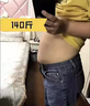 唯蜜瘦3.0便攜式腹部按摩儀九大體質(zhì)溫灸片熱敷按摩儀 唯蜜瘦3.0旗艦版一盒（96天） 曬單實(shí)拍圖