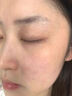 焦博士日本曬后修復(fù)面膜修復(fù)敏感皮膚屏障受損泛紅醫(yī)美用防曬傷急救白 曬單實拍圖