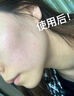 維特絲氨基酸洗面奶男女士500g控油祛痘深層清潔黑頭粉刺護(hù)膚美白潔面乳 曬單實(shí)拍圖
