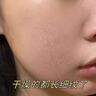 Newliann醫(yī)用重組人表皮生長(zhǎng)因子噴霧外用修復(fù)皮膚屏障凝膠原蛋白補(bǔ)水保濕 曬單實(shí)拍圖