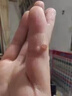 猴子去除藥膏刺猴專(zhuān)用的藥刺猴子尋常疣魚(yú)鱗痣跖疣專(zhuān)用藥腳底趾疣根肉粒疙瘩去疣瘊子特治療效藥 水楊酸軟膏 一盒【肉粒刺猴疙瘩去除疣瘊】 曬單實(shí)拍圖