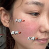 焦博士日本曬后修復面膜軍訓曬傷急救敏感皮膚屏障受損泛紅美白青少年防 曬單實(shí)拍圖