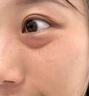 Losoki瑞士進(jìn)口眼霜淡化細紋提拉緊致黑眼圈去眼袋抗皺抗衰老護膚品禮物 曬單實(shí)拍圖