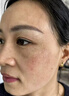 同仁堂美白祛斑霜淡化黑色素去斑雀斑黃褐斑老年斑曬斑煙酰胺男女士面霜 第2瓶半價(jià)【改善暗沉 水潤透亮】 曬單實(shí)拍圖