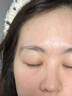 OHBT祛痘膏60g青春痘閉孔粉刺收縮毛孔專用學(xué)生男女凝膠男士化妝品 曬單實(shí)拍圖
