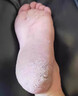腳氣凝膠癢脫皮爛腳丫真菌感染非藥正品腳氣腳臭的香港腳皮膚用去看腳縫根癢得腳氣腳臭真菌感染干癢抑菌 1盒體驗裝【20g/瓶】 曬單實(shí)拍圖