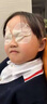 眼貼緩解眼疲勞改善視力青少年近視i恢復治i療近視眼貼葉黃素進(jìn)口 特效:1盒裝【散光近視眼貼】 曬單實(shí)拍圖